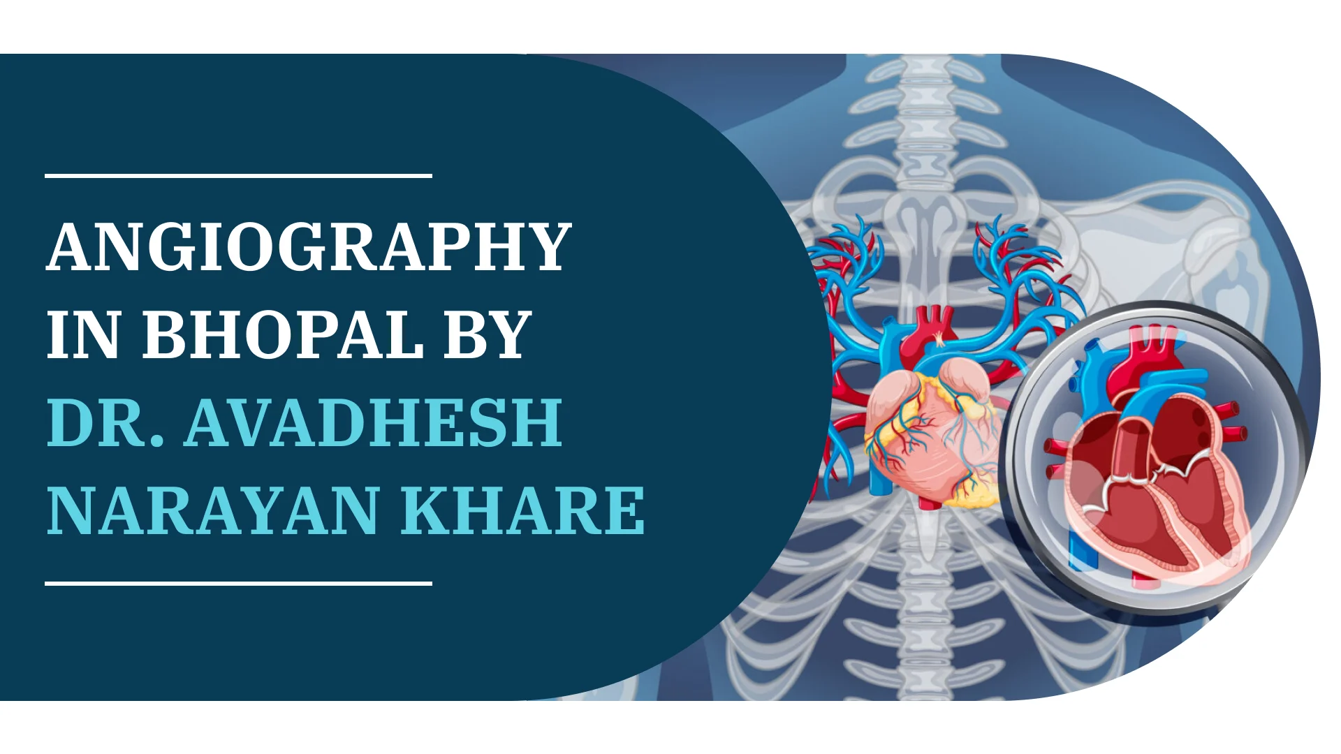 Angiography in Bhopal by Dr. Avadhesh Narayan Khare