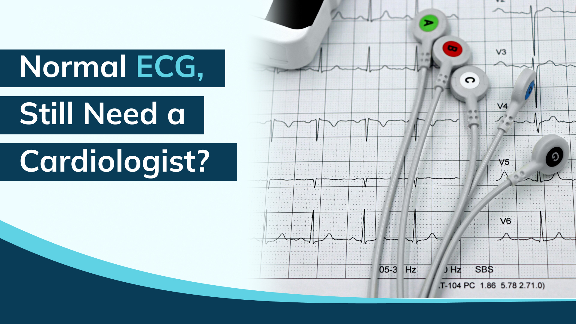 When Should You Visit a Cardiologist Even If Your ECG Is Normal?
