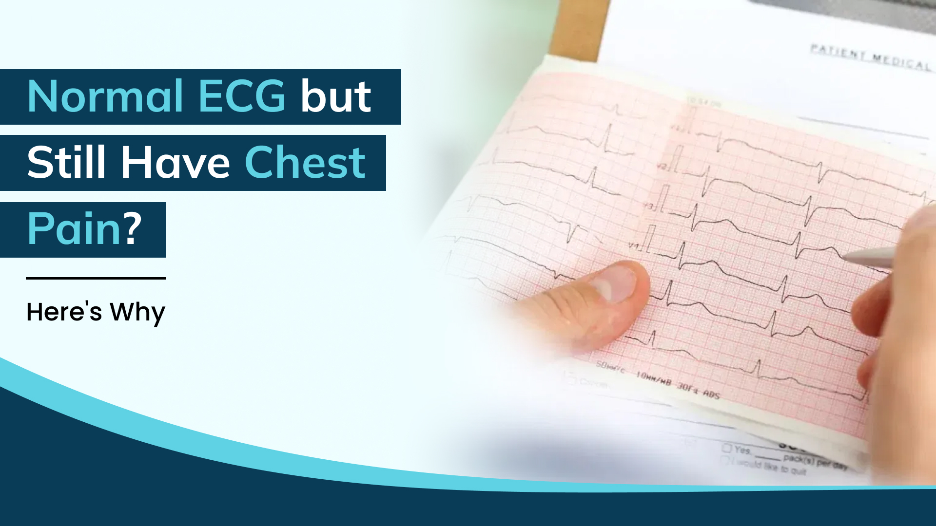 ECG Normal but Still Having Chest Pain? Here’s Why You Shouldn’t Ignore It